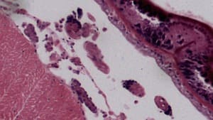 Bilateral Smoothing Filter — After