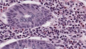 Blur Filter — Before