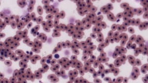 Brightness Filter — Before