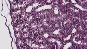 Conservative Smoothing Filter — After