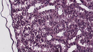 Conservative Smoothing Filter — Before