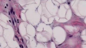 Gaussian Blur Filter — Before