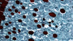 Gaussian Sharpen Filter — After