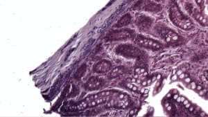 Level Clipping Filter — After