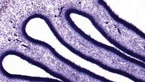 Median Filter — Before