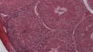 Sharpen Filter — After