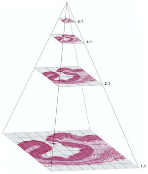 Deep Zoom Pyramidal Image
