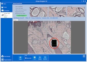 Scan with Missing Fields
