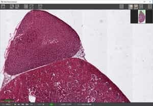 Scan with Poor Flat Field