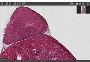 Image with Level Clipping Filter