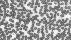 Grayscale Filter — After