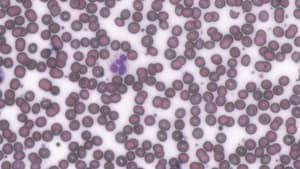 Grayscale Filter — Before